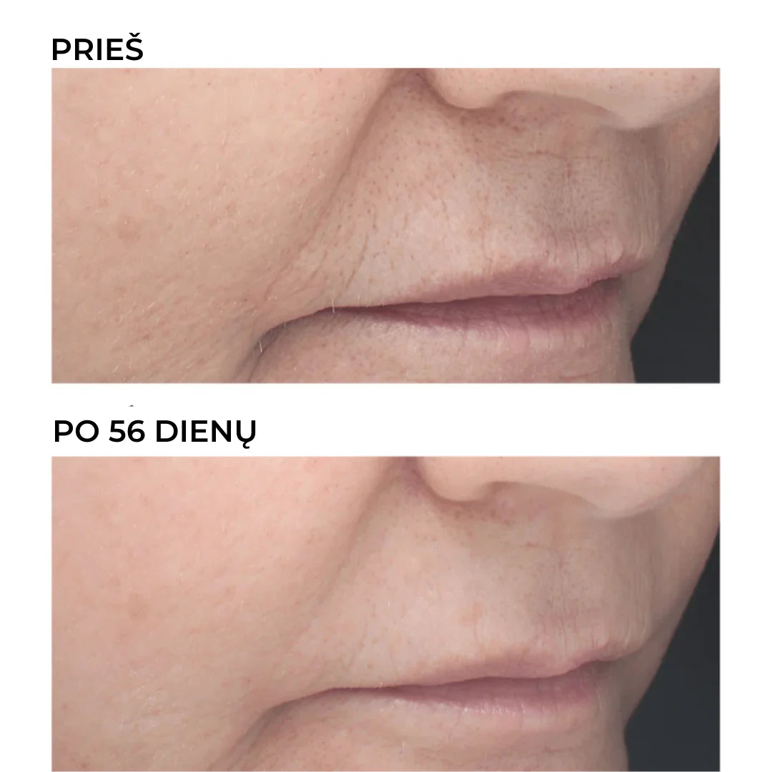 DERMEDEN RETINAL - naktinis retinoidų 6% koncentratas nuo raukšlių, 30 ml - KONCENTRATAS IŠ DERMEDEN - TIK €67! Apsipirk dabar GROŽIO ALCHEMIJA