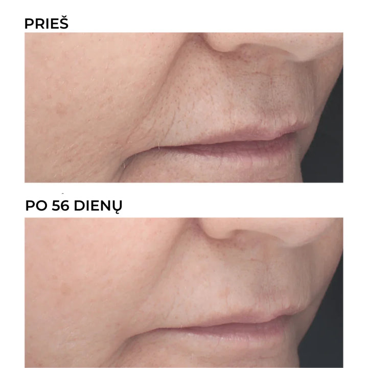 DERMEDEN RETINAL - naktinis retinoidų 6% koncentratas nuo raukšlių, 30 ml - KONCENTRATAS IŠ DERMEDEN - TIK €67! Apsipirk dabar GROŽIO ALCHEMIJA